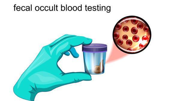 آزمایش خون مخفی مدفوع چیست و برای چه انجام می شود؟