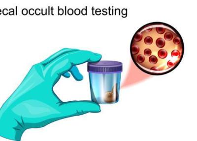 آزمایش خون مخفی مدفوع چیست و برای چه انجام می شود؟