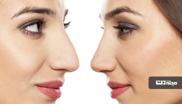 کوچک کردن بینی تنها با 5 روش آسان