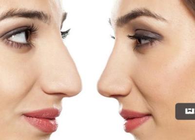 کوچک کردن بینی تنها با 5 روش آسان